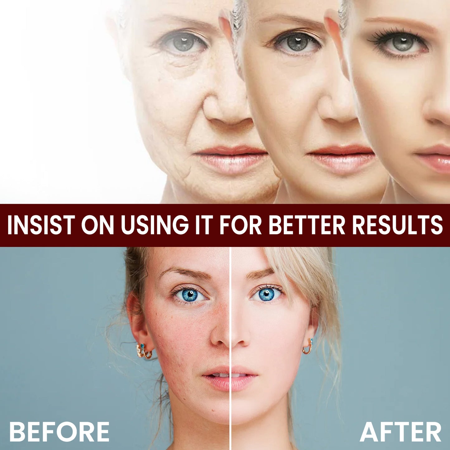 Rice Anti-wrinkle Facial Cream Acne Melasma Treatment Pigmentation Whitening Face Lifting Beauty Moisturizer Korean Cosmetics30g