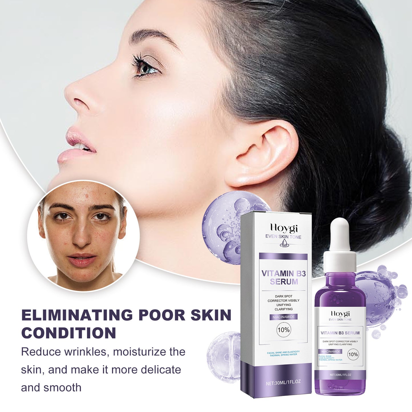 Powerful Dark Spots Remover Whitening Serum Face Freckle Melanin Correcting Anti Pigmentation Brighten Skin Beauty Care Products