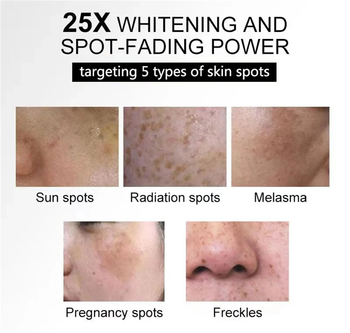 Powerful Dark Spots Remover Whitening Serum Face Freckle Melanin Correcting Anti Pigmentation Brighten Skin Beauty Care Products
