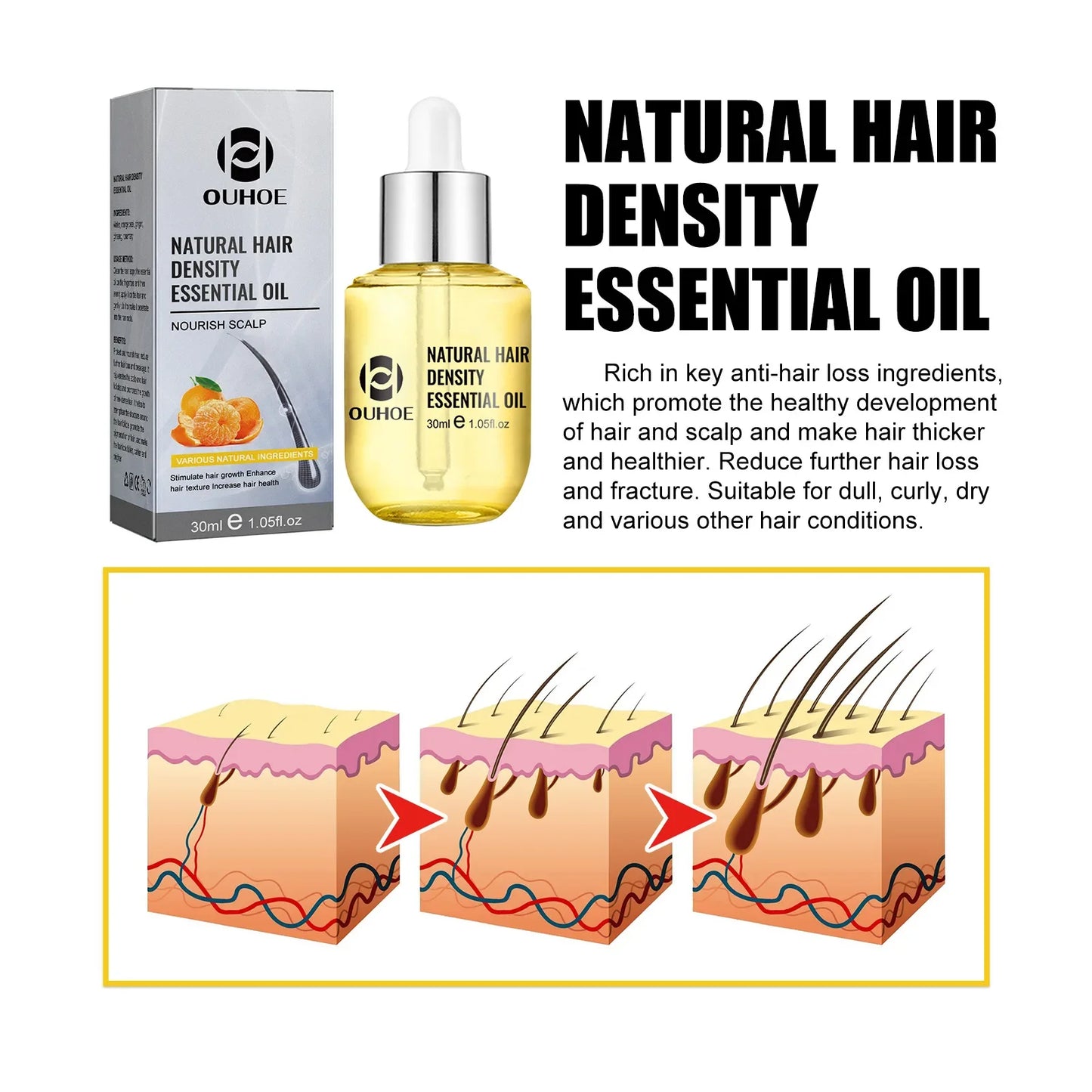 Hair Growth Essential Oil Treatment Seborrheic Alopecia Follicle Repairing Reduce Hairline Baldness Dense Grow Fast Hairs Lotion
