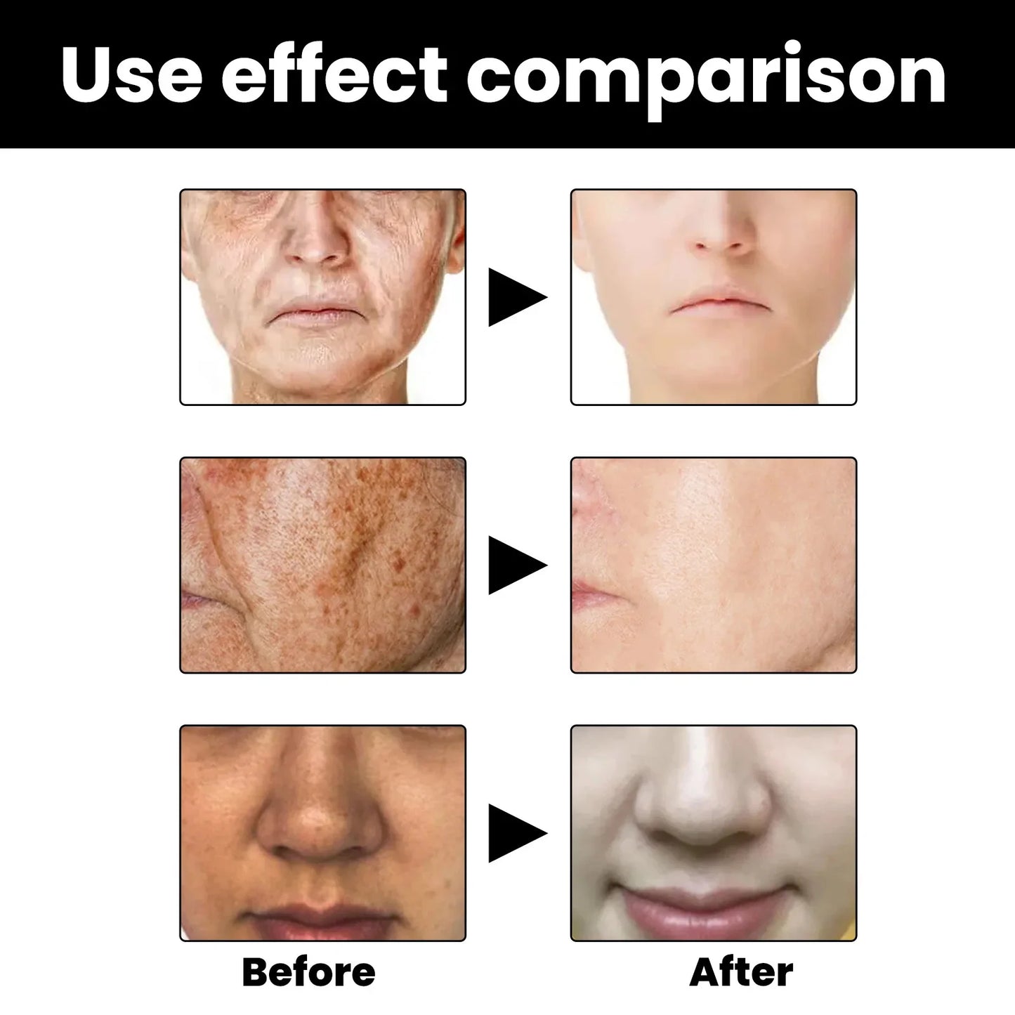 Powerful Dark Spots Remover Whitening Serum Face Freckle Melanin Correcting Anti Pigmentation Brighten Skin Beauty Care Products
