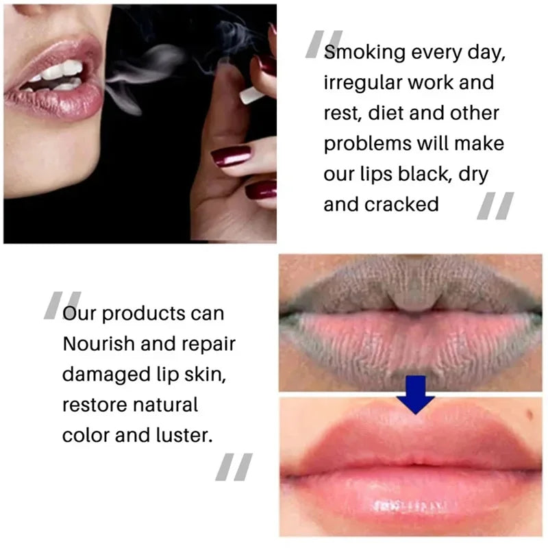 Remove Dark Aloe Lip Balm Lightening Melanin Mask Lip Gloss Oil Exfoliating Clean Moisturizer Makeup Korean Beauty Products