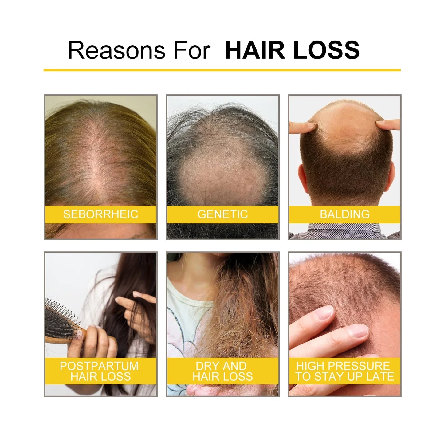 Hair Growth Essential Oil Treatment Seborrheic Alopecia Follicle Repairing Reduce Hairline Baldness Dense Grow Fast Hairs Lotion