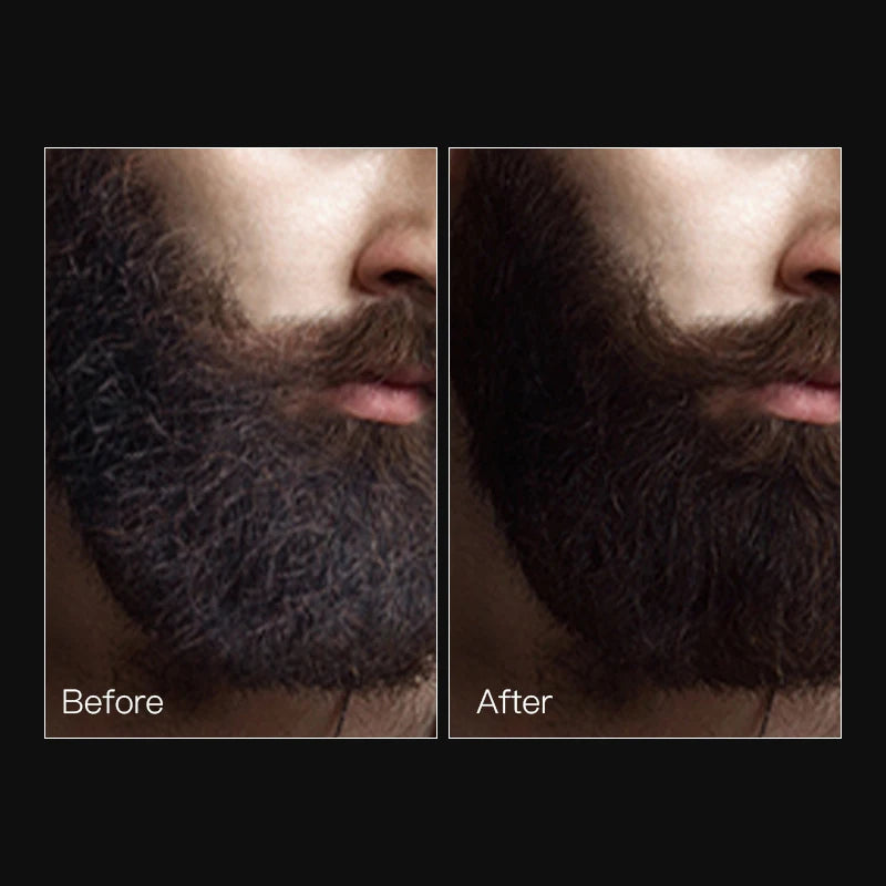 50ml Facial Hair Growth Beard Growth Essential Oil Improves Frizz Fast Powerful Hair Growth Liquid Man Beard Modifier Product