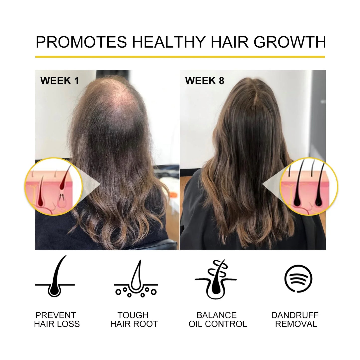Hair Growth Essential Oil Treatment Seborrheic Alopecia Follicle Repairing Reduce Hairline Baldness Dense Grow Fast Hairs Lotion