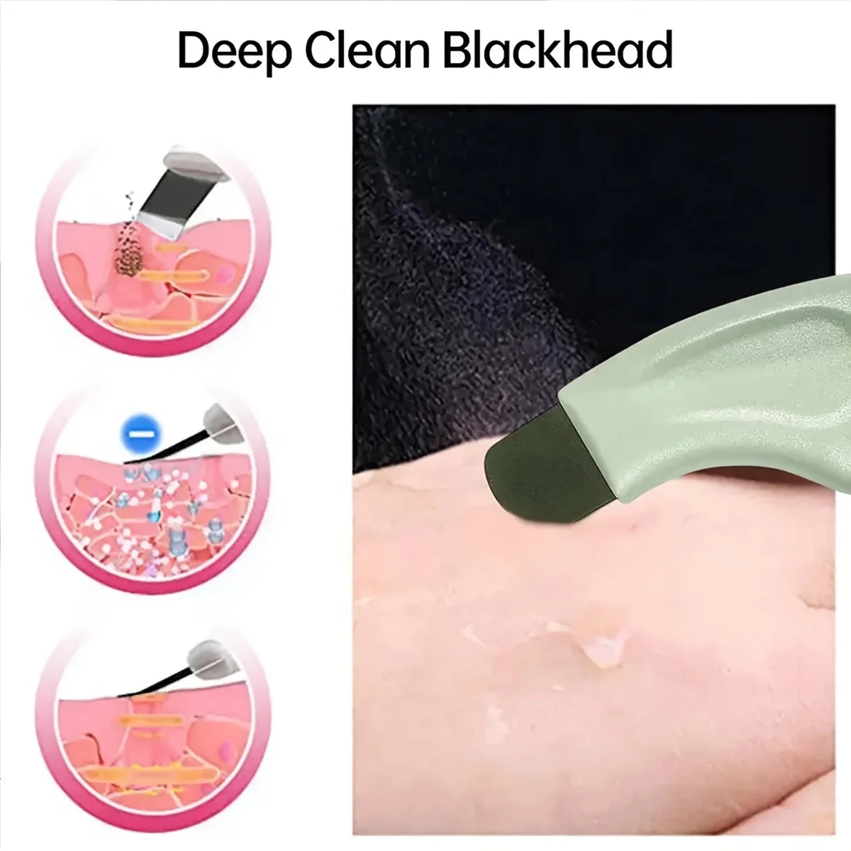 Facial Blackhead Removal Tool Nose Deep Cleansing Remove Acne Handheld Beauty Care Tool Skin Care Auxiliary Tool