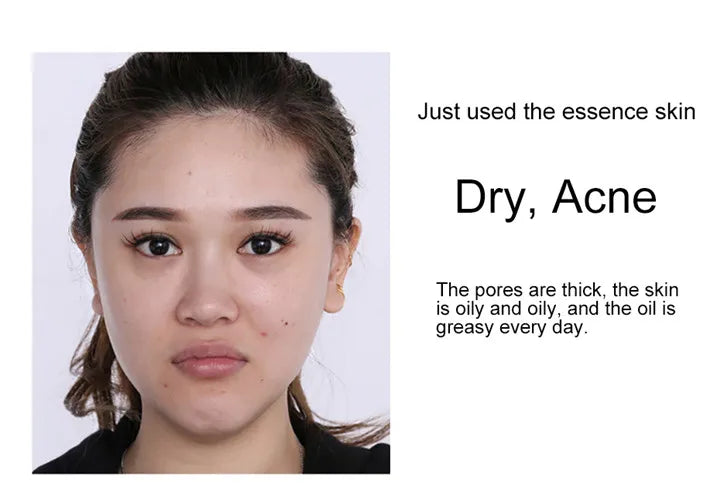 24k Gold Face Serum Brightening Skin Care Products Hyaluronic Acid Niacinamide Facial Nourish Smooth Care Beauty Health
