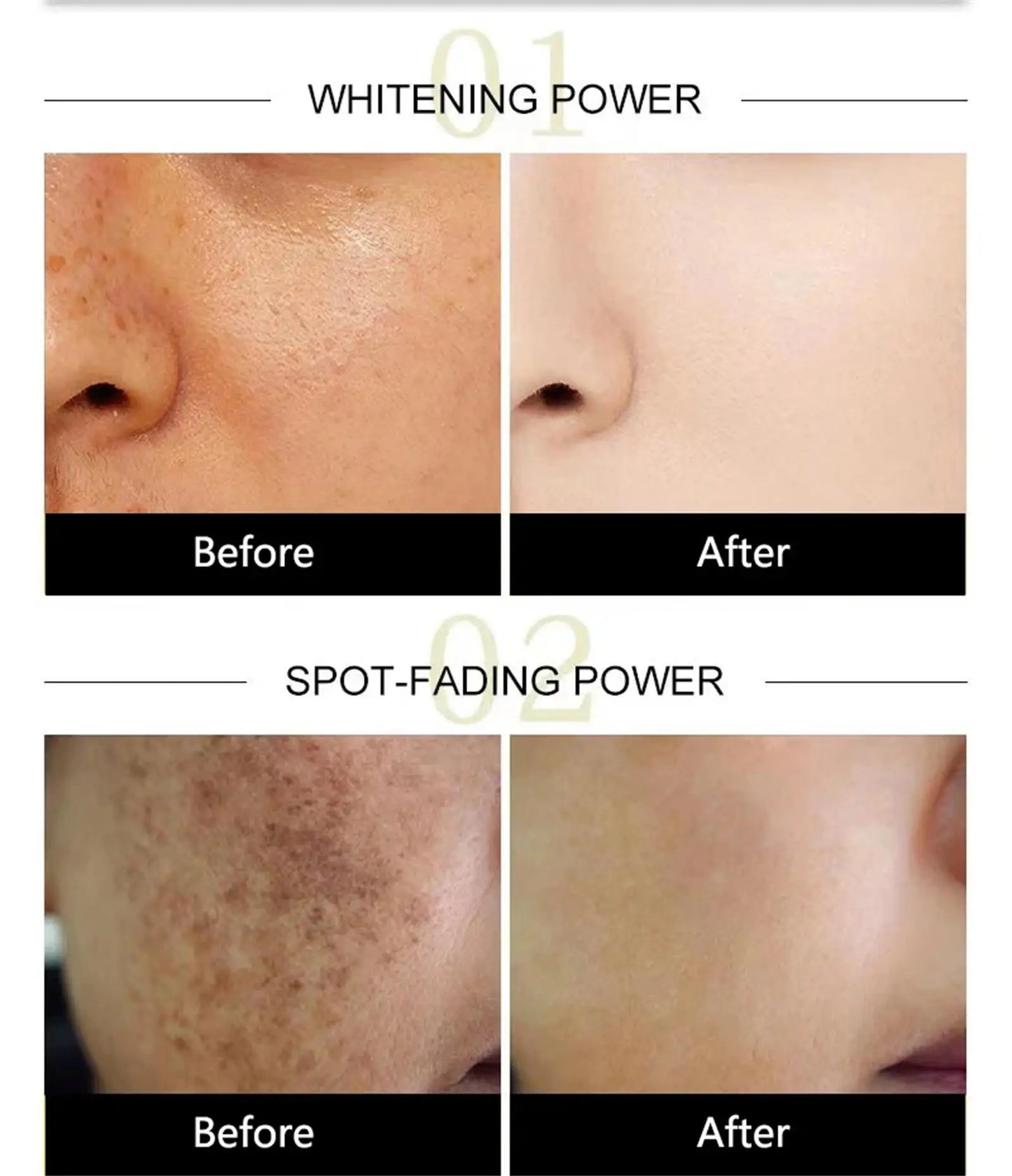 Powerful Dark Spots Remover Whitening Serum Face Freckle Melanin Correcting Anti Pigmentation Brighten Skin Beauty Care Products
