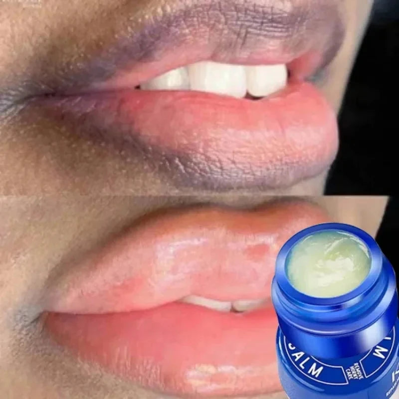 Remove Dark Aloe Lip Balm Lightening Melanin Mask Lip Gloss Oil Exfoliating Clean Moisturizer Makeup Korean Beauty Products
