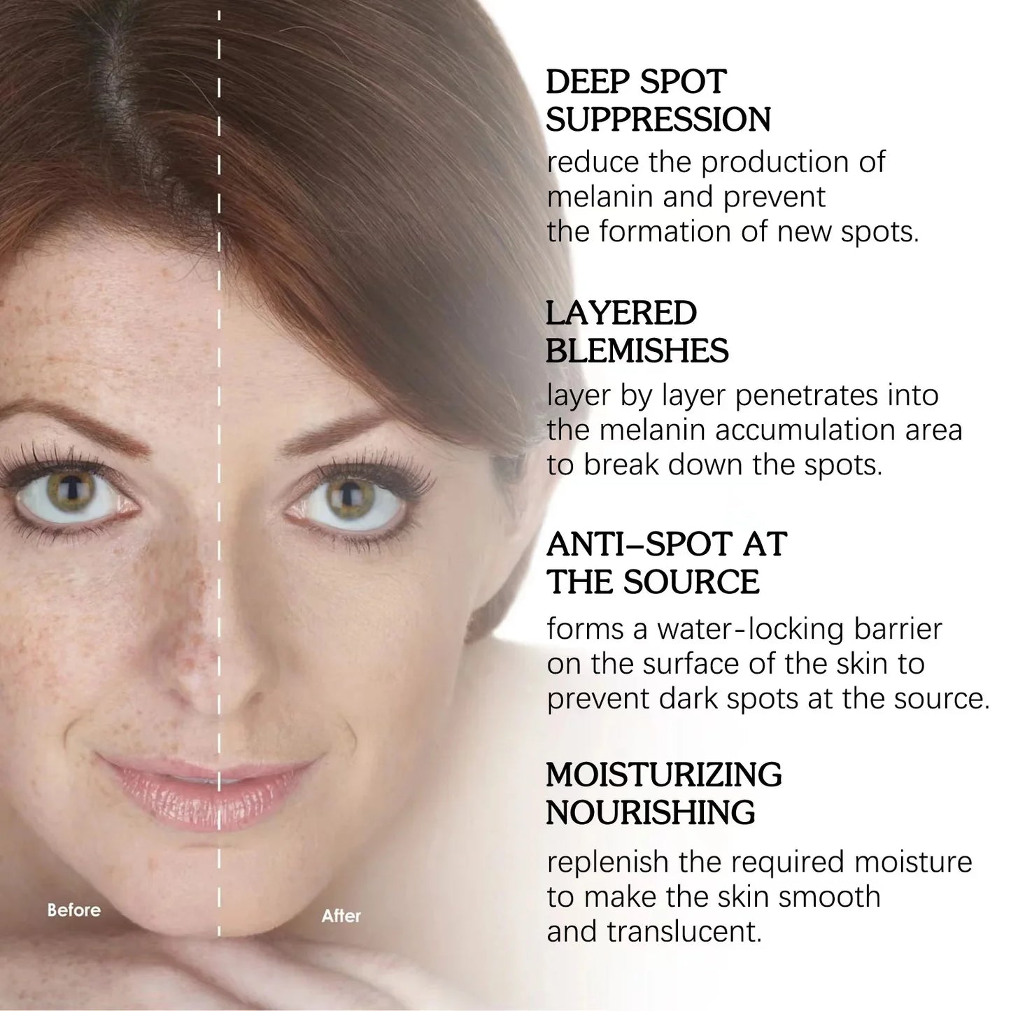 Powerful Dark Spots Remover Whitening Serum Face Freckle Melanin Correcting Anti Pigmentation Brighten Skin Beauty Care Products