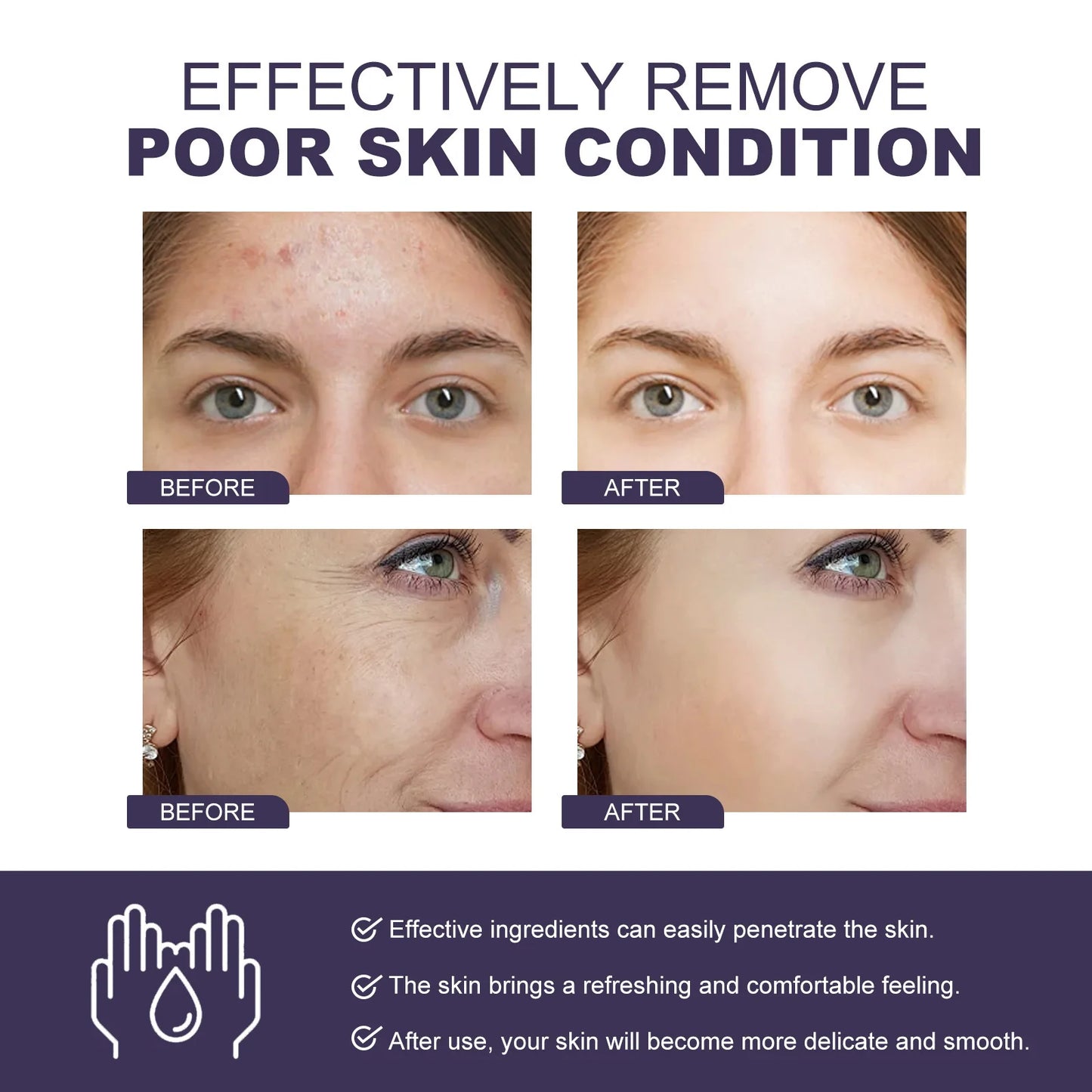 Powerful Dark Spots Remover Whitening Serum Face Freckle Melanin Correcting Anti Pigmentation Brighten Skin Beauty Care Products