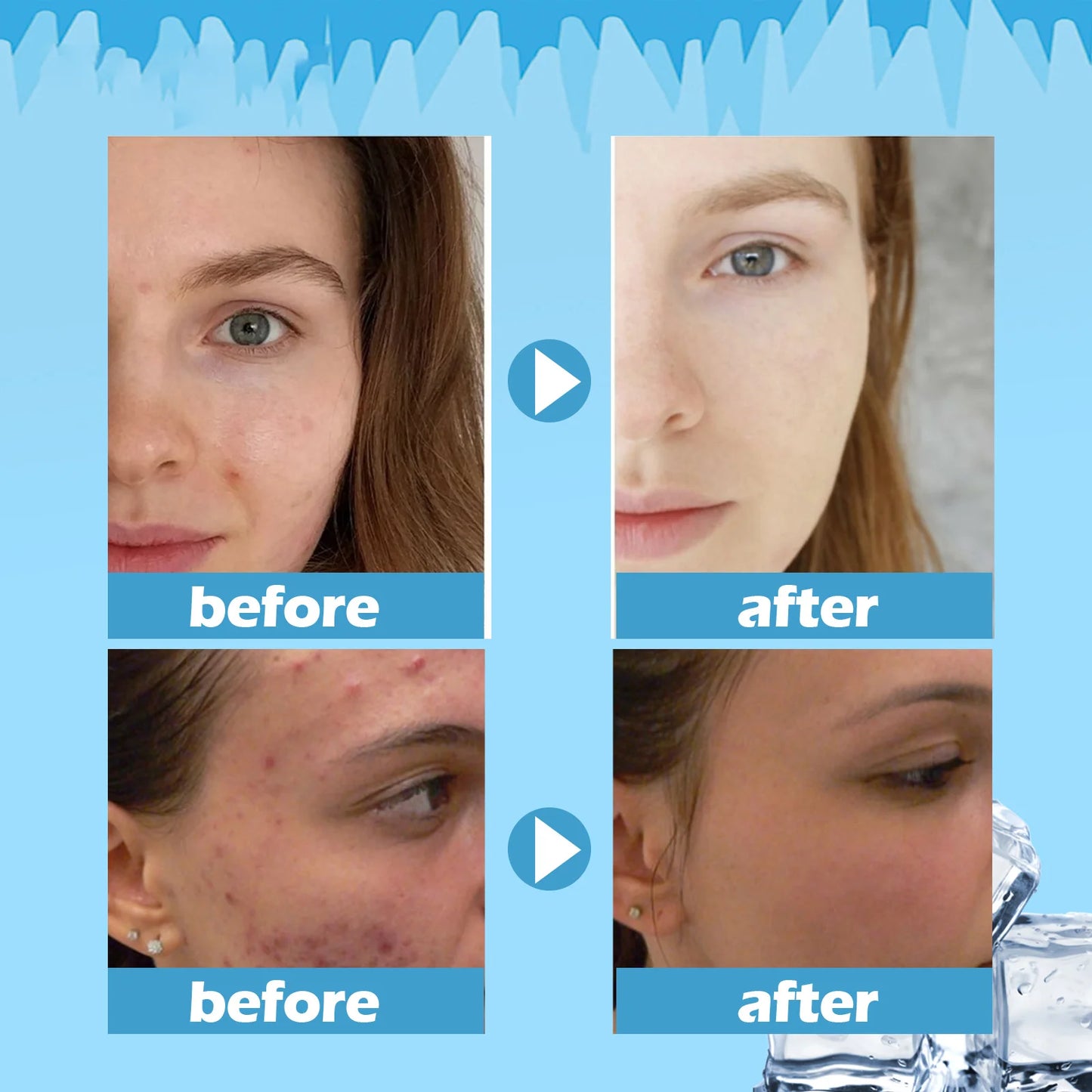 Eelhoe Facial Masks Repair Face Skincare Firming Hydrating Moisturizing Face Mask Remove Acne Brighten Facial Skin Care Product