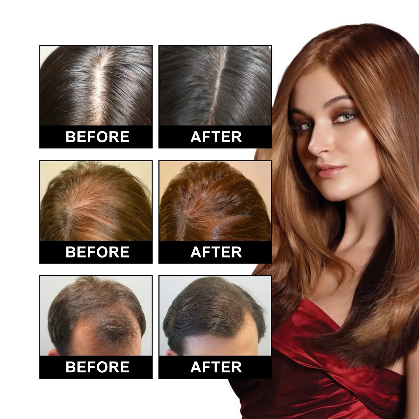 Hair Growth Essential Oil Treatment Seborrheic Alopecia Follicle Repairing Reduce Hairline Baldness Dense Grow Fast Hairs Lotion
