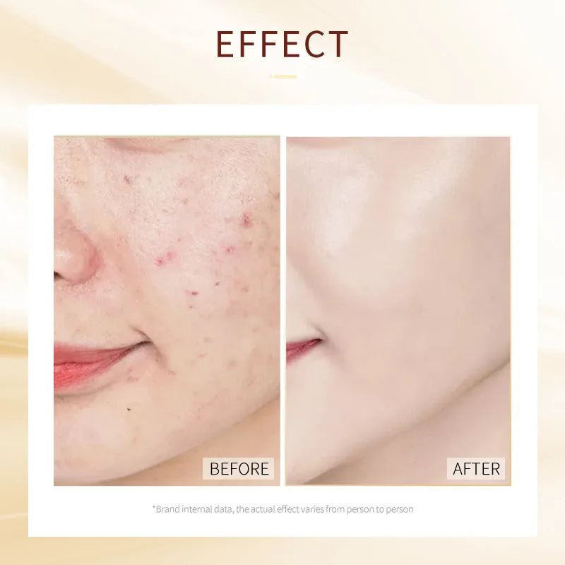 8pcs LAIKOU Moisturizing Facial Mask Hydrating Sleeping Face Sheet Masks Face Mask Beauty Korean Skin Care Products